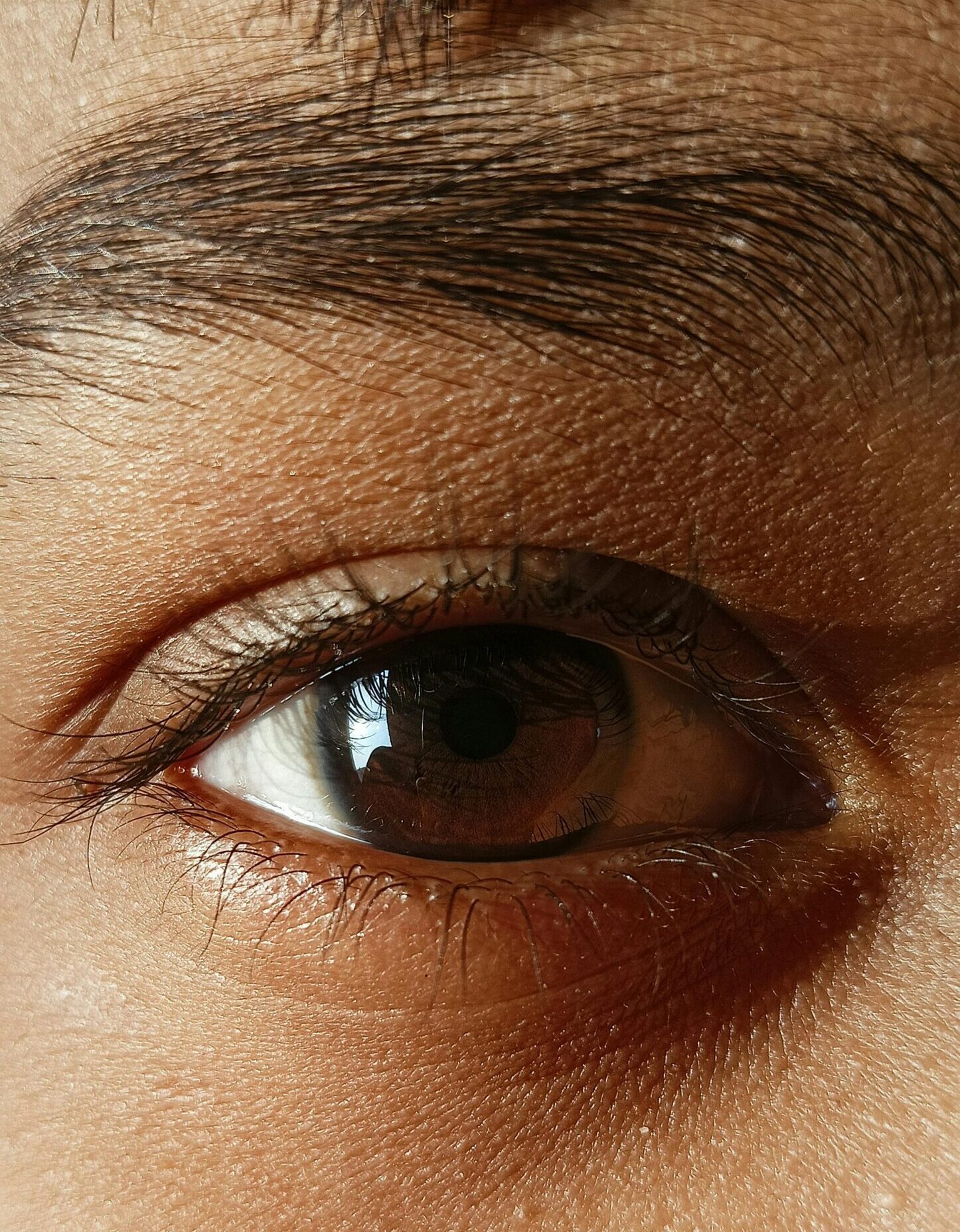 pexels-soubhik96-30465454 traitement cernes et contour des yeux médecine esthétique